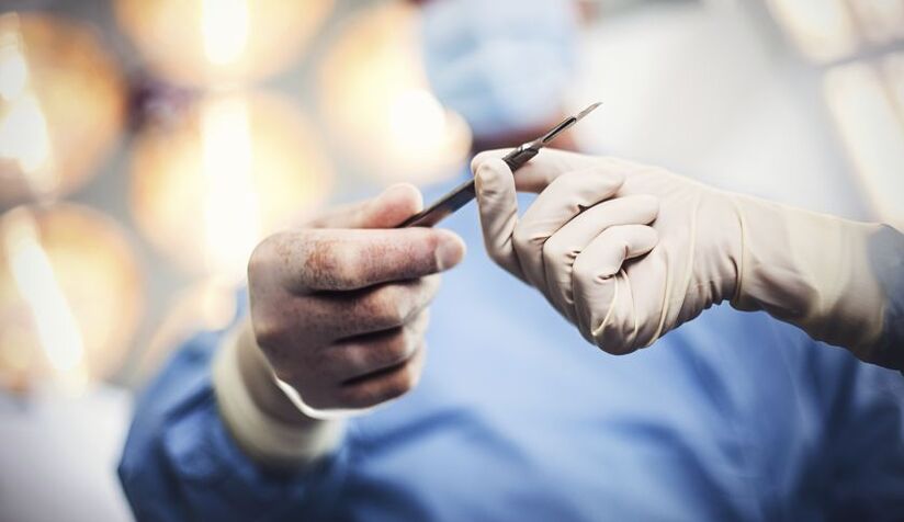 surgical enlargement of the penis